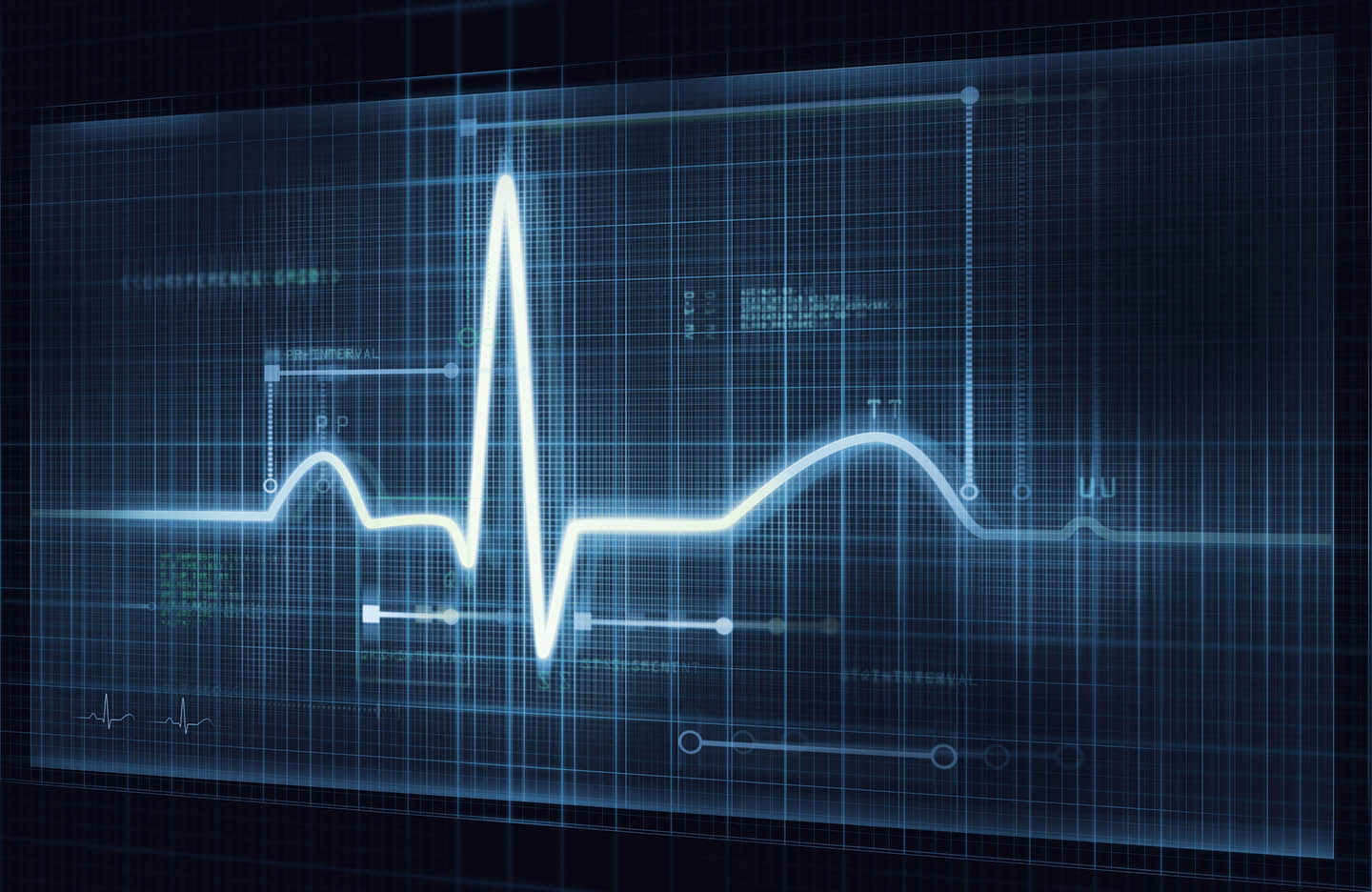 AI-based Heart Monitor